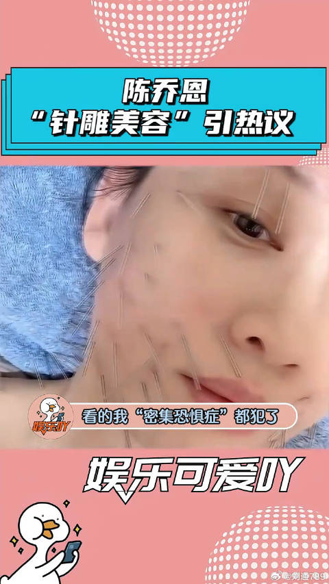 陈乔恩晒出“针雕”保养方法，看着太疼了！ 容嬷嬷 微博VC计划