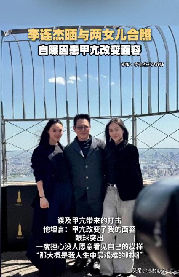 李连杰因患甲亢改变面容,网友:邪门!现在年轻了十几岁