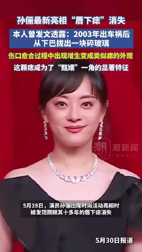 孙俪唇下痣20年变迁，从无到有成标志