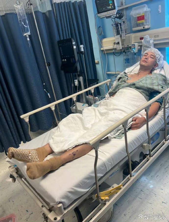 陈学冬晒病床照:车祸后历经三次手术还是留下了后遗症!