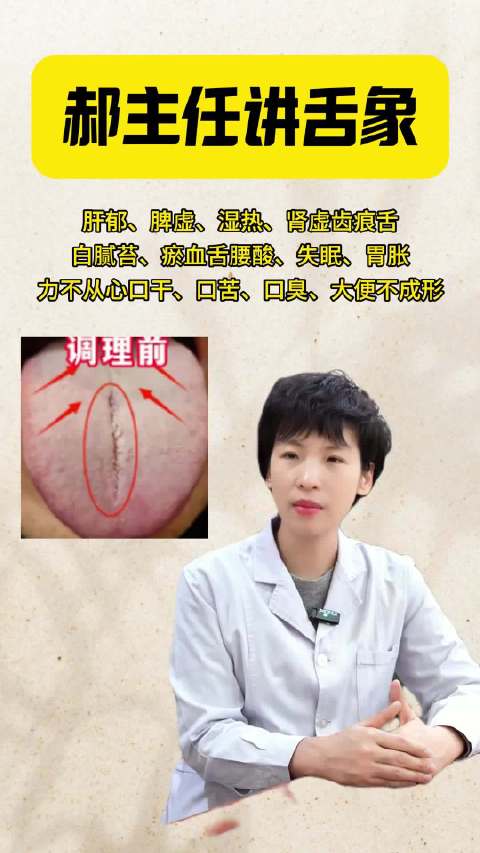 郝主任揭秘中医舌诊，观察舌象守护健康