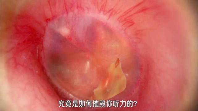 千万不要长时间戴耳机 长期戴耳机，是如何摧毁你听力的？