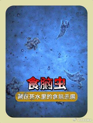豪斯医生：血泪、神经失常、97%致死率！水体里的食脑恶魔！