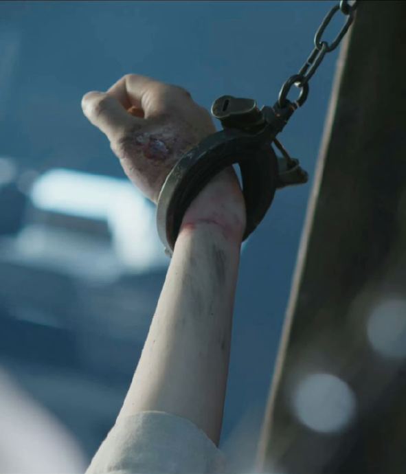 丁禹兮拍古装被道具箭穿手缝6针，伤疤至今清晰