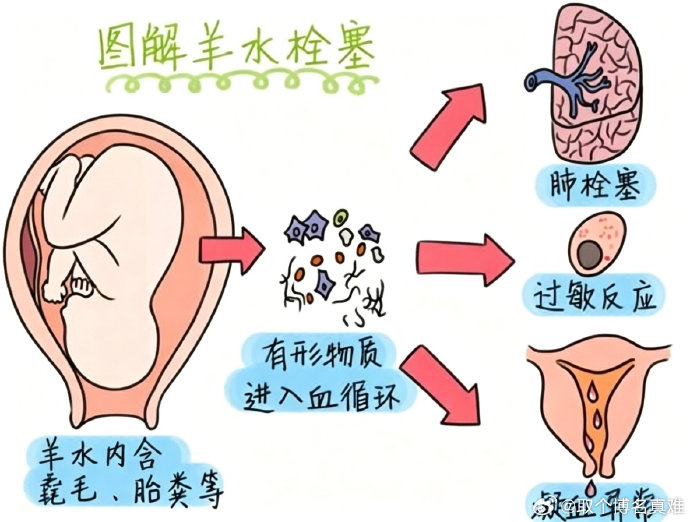 28岁产妇目前有苏醒的迹象了吗？