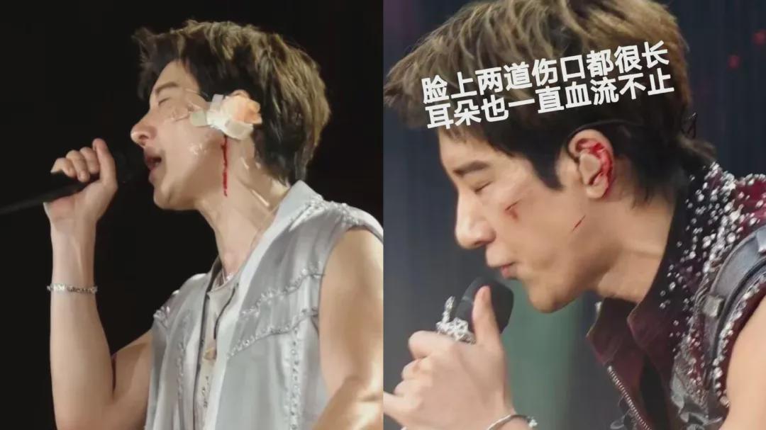 心寒呀，王力宏缝了39针的受伤照被疯传，评论区却在关注讨论这个|乐坛|刘德华演唱会|王力宏