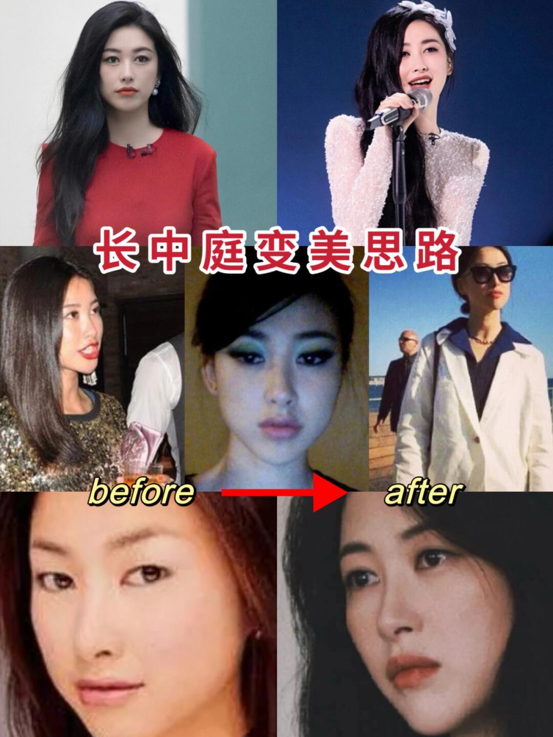 高智感女神朱珠|长中庭变美思路