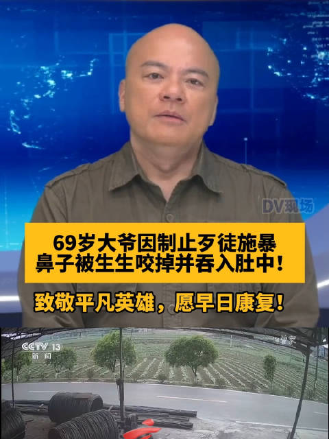 69岁老人制止歹徒被咬掉鼻子