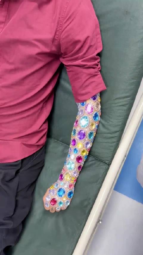 小丑的钻石手臂