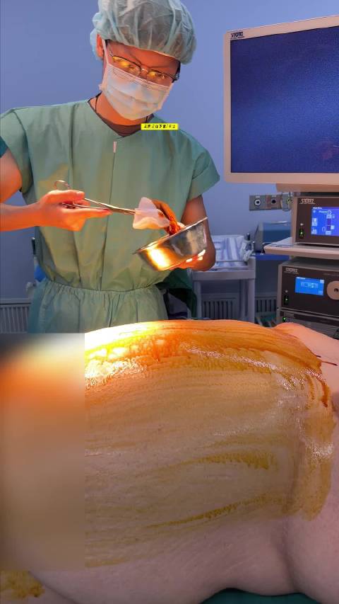 要想减肥记住这5句话 健康奥斯卡一分钟精选视频扶持计划