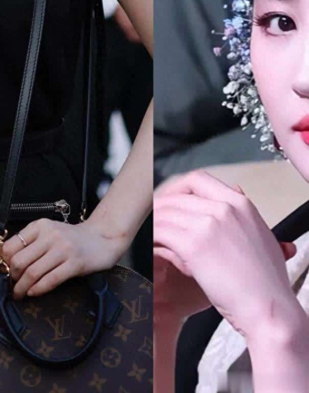 神仙姐姐也逃不过!刘亦菲手腕惊现血痕,网友:真·猫奴