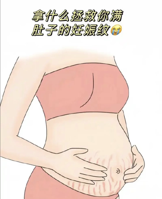 产后妊娠纹还有办法淡化或修复吗? 产后妊娠纹还有办法淡化或修复吗?