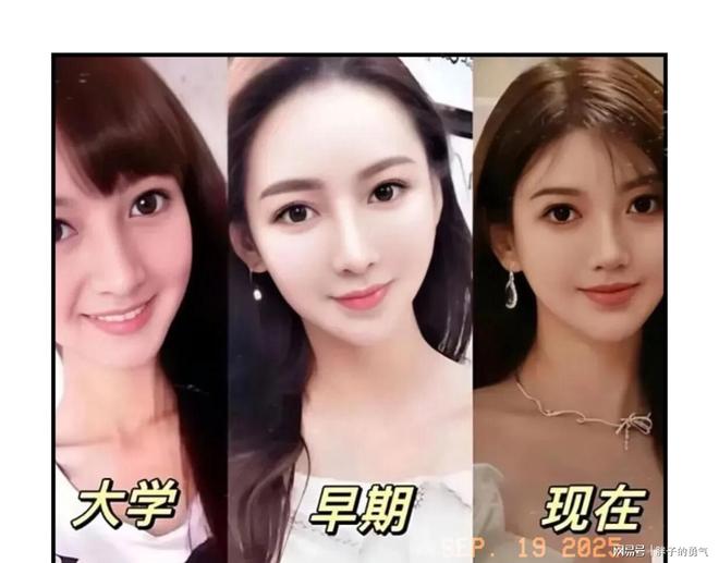 黄晓明前女友叶柯谈网红脸：不高级，自曝21岁整容