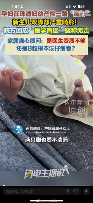 花一万多产检正常,孩子出生却双脚畸形? 花一万多产检正常,孩子出生却双脚畸形?