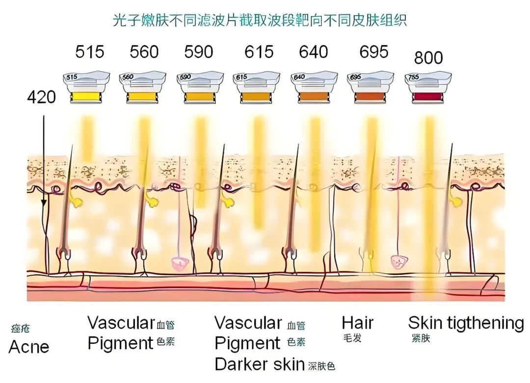 光子嫩肤和水光针项目可以同一天做吗?