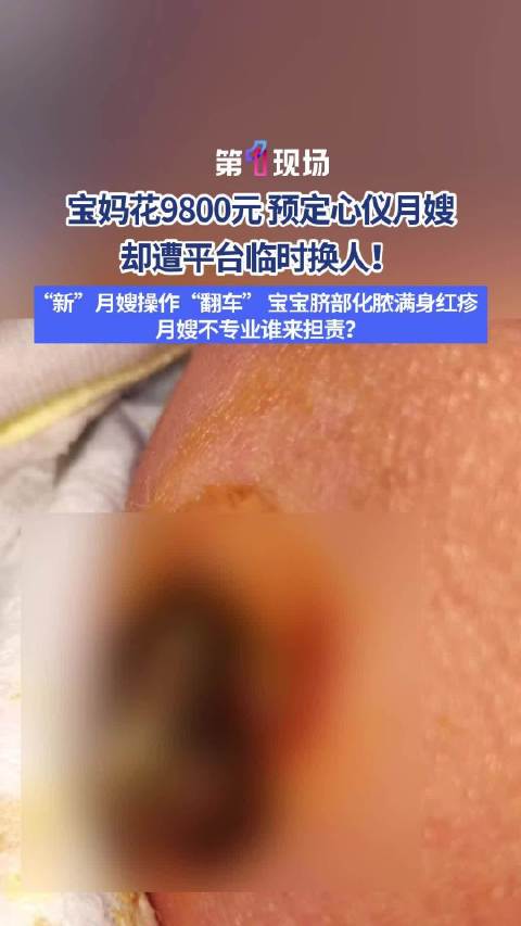 9800元月嫂致新生儿肚脐流血化脓 家长投诉，平台回应！