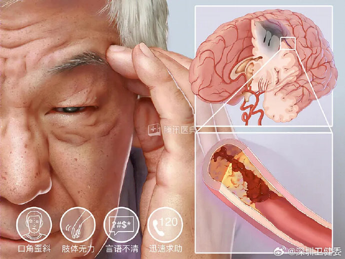 为什么秋老虎时节容易诱发心血管问题? 为什么秋老虎时节容易诱发心血管问题?