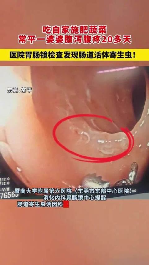 女子自制有机肥种菜感染寄生虫女子自己种菜吃感染寄生虫