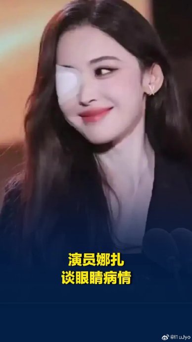 娜扎眼睛问题具体是什么旧疾? 娜扎眼睛问题具体是什么旧疾?