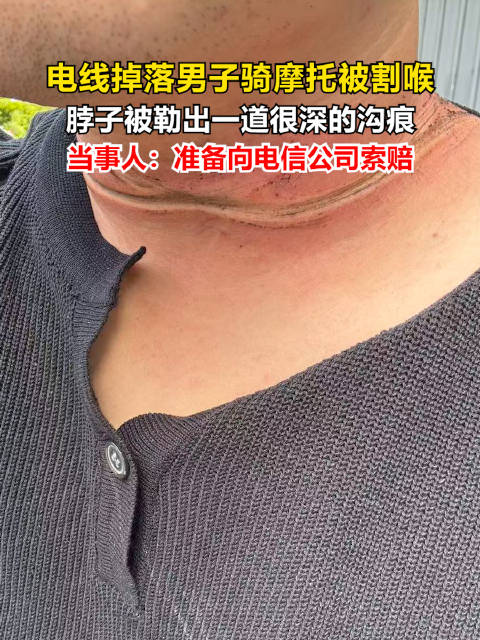 男子骑摩托被掉落电线割喉