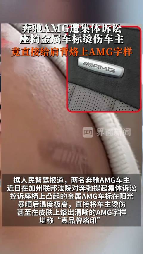 多名奔驰车主控诉被座椅金属标烫伤