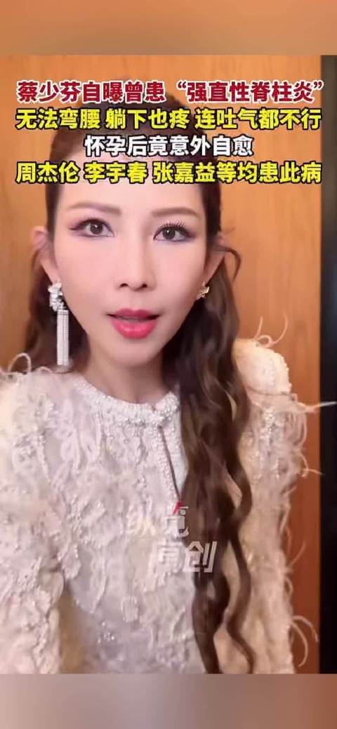 蔡少芬自曝曾患强制性脊柱炎