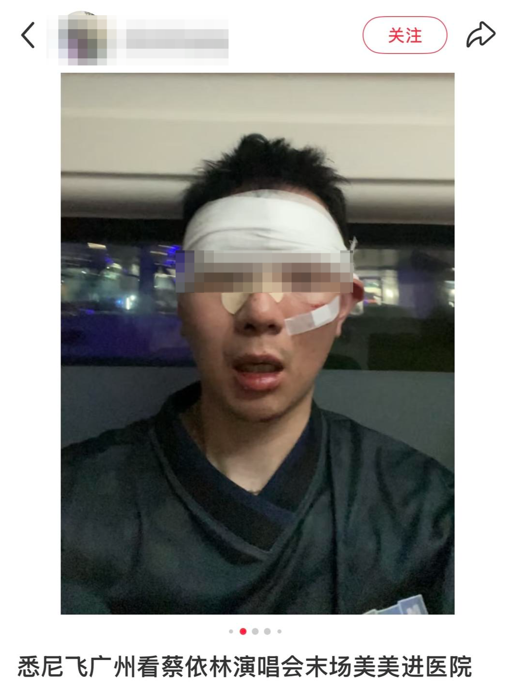 多名观众称在广东奥体看蔡依林演唱会摔倒受伤，主办方道歉