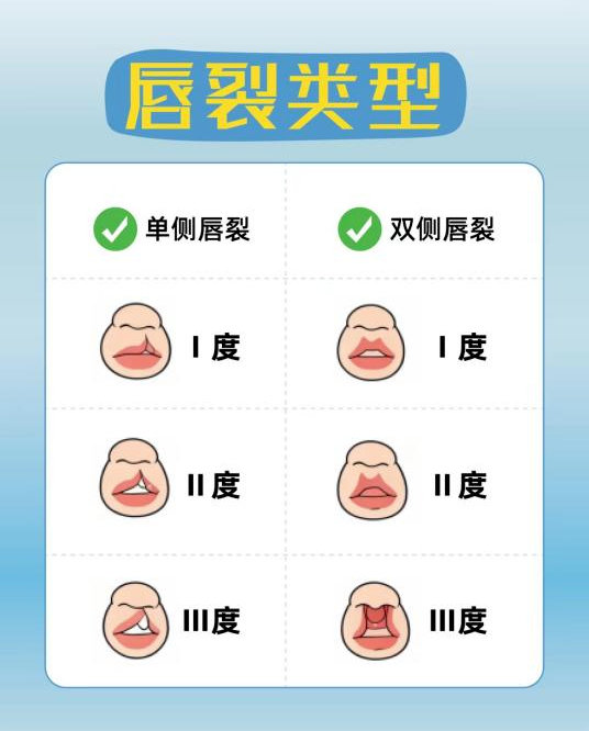 李嫣的唇腭裂修复一共经历了多少次手术? 李嫣的唇腭裂修复一共经历了多少次手术?
