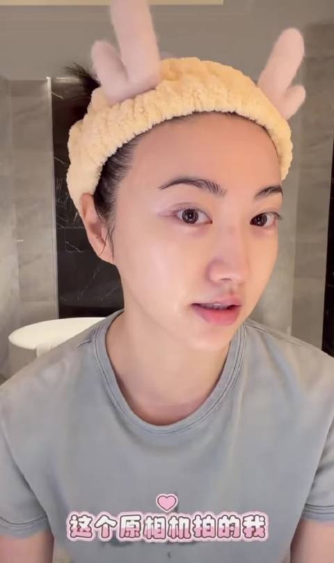 这次自己亲自解释鼻梁上的疤咋来的，暴力甜妈 不能模仿啊