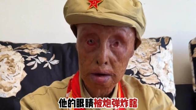 左眼炸瞎，十指尽断，面容全损，他就是抗日英雄赵连北