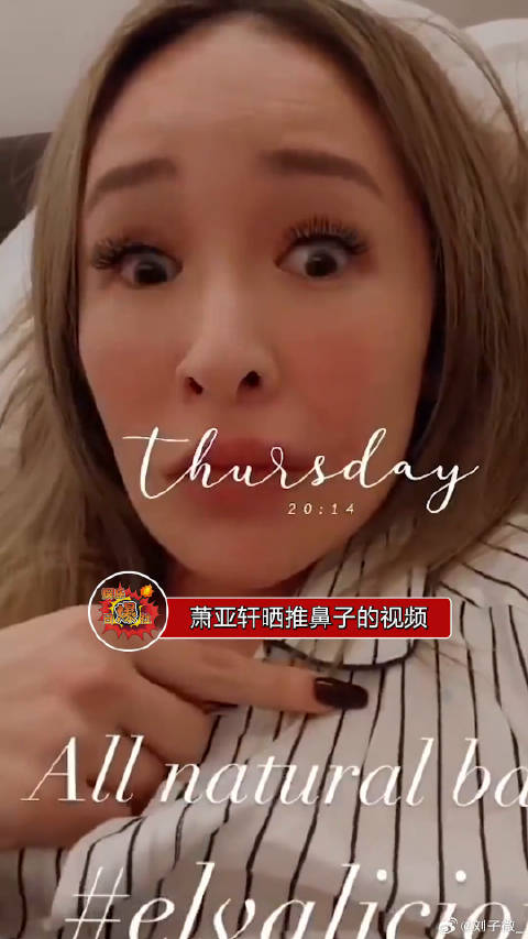 萧亚轩晒推鼻子的视频澄清自己没有整容，只是缝了双眼皮
