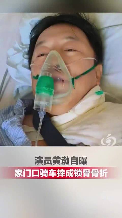 52岁演员黄渤骑车摔骨折 ，并晒出住院治疗视频，自嘲“多么痛的领悟”