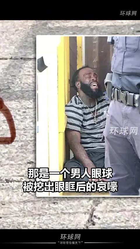 美两男子冲突1人被刺伤1人被挖眼
