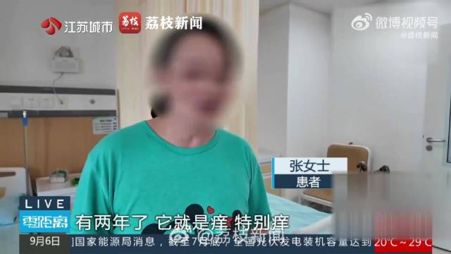 腿上冒出小鼓包要注意了年轻人也要留意静脉曲张信号