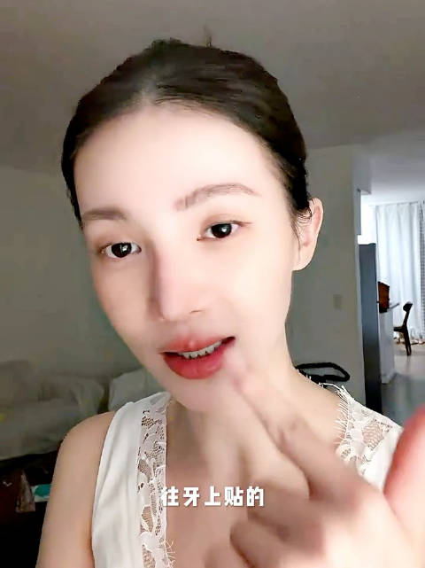 金晨牙钻实为装饰贴，偶像包袱全无