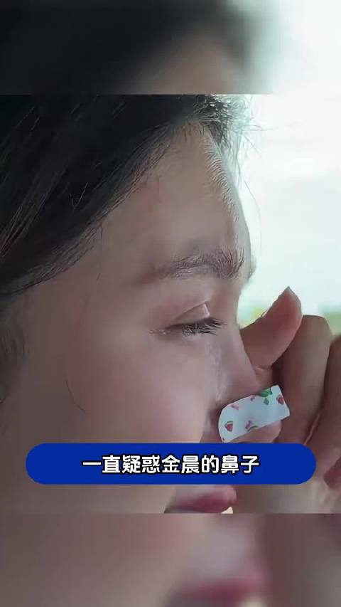 原来金晨鼻子上经常贴的不是胶布