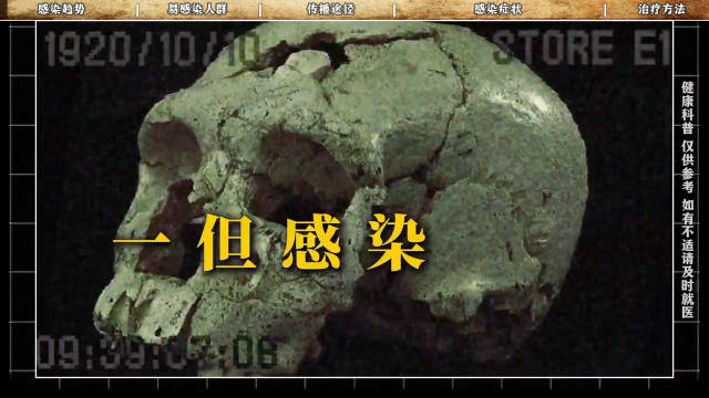 本视频为正经科普内容，无任何不良引导，因人而异，仅供参考，不涉及医疗建议，如有不适请及时就医