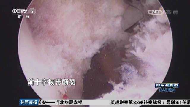 徐云丽重伤崩溃，郎平一句“小丽回来了”让她泪崩