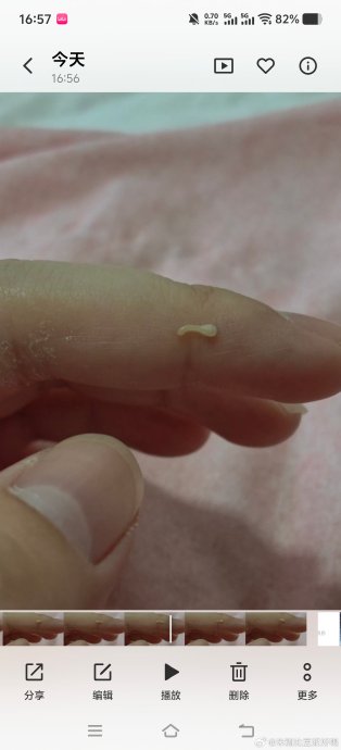 猫身上摸到不明虫子，博主求助博物杂志鉴别