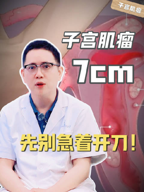 7cm肌瘤先别开刀！医生的分两步走，子宫上不留疤！健康奥斯卡