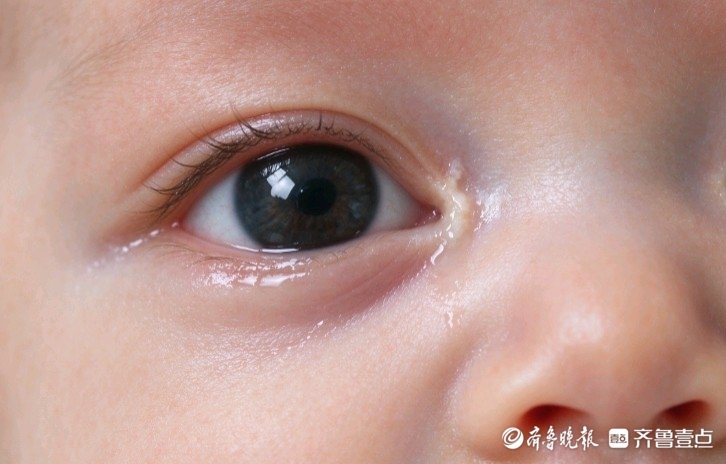 宝宝总眼泪汪汪、眼屎多，别再当成上火！邵丹丹科普新生儿泪囊炎