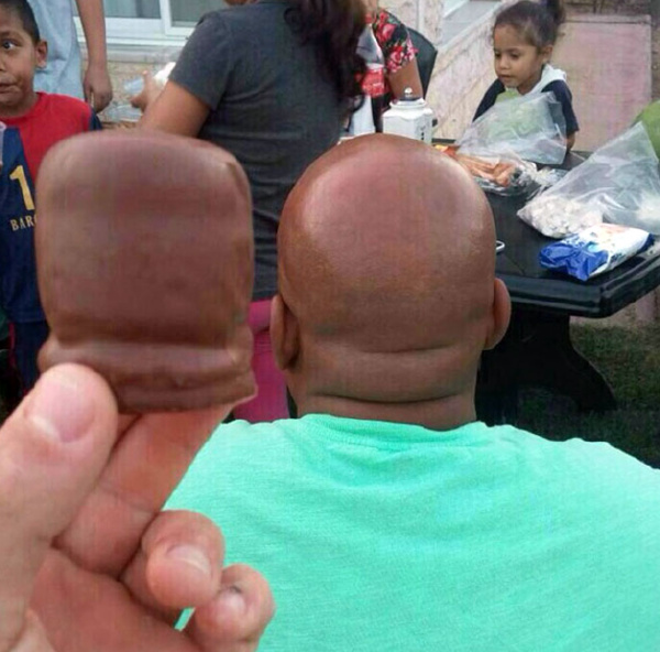 吸尘器治大姨妈送进医院 每日轻松一刻6月13日晚间版