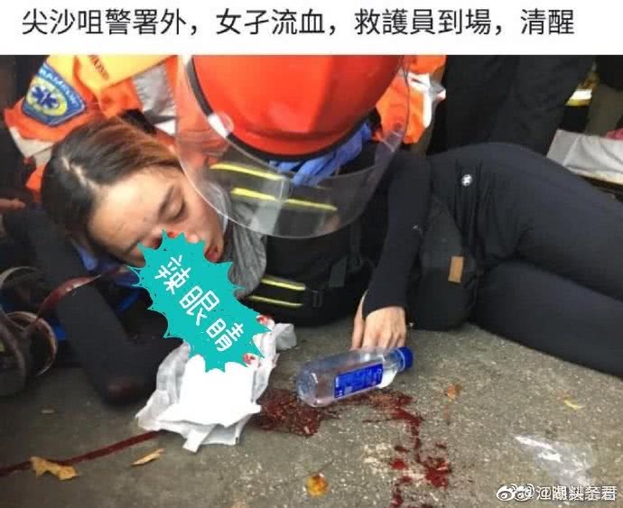 眼球受伤的女示威者 图自央视新闻
