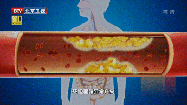 颈动脉有支架能用生命光动仪吗？