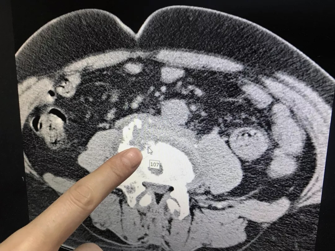 胡先生的医学影像资料