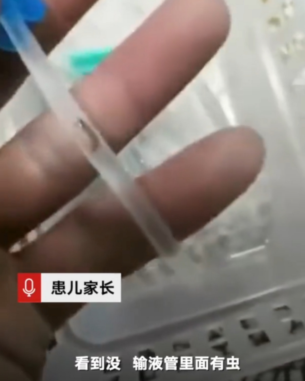 3岁患儿输液管现虫状异物 样品将送省级机构检测