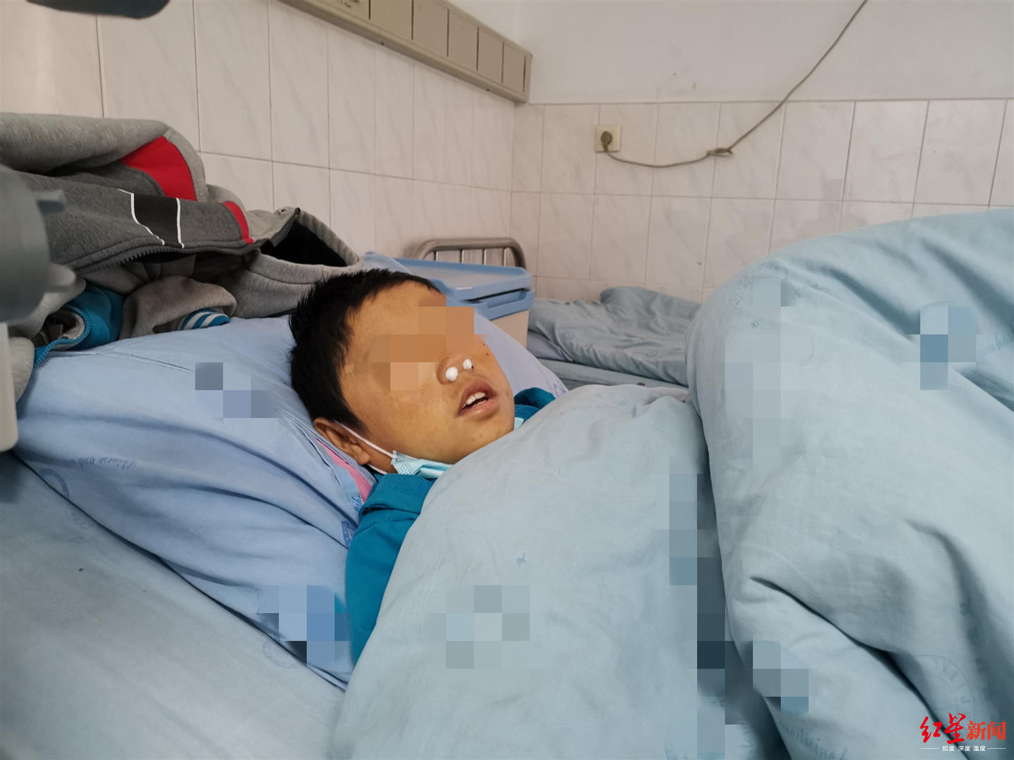 男孩患上罕见“吸血鬼症” 母亲:坚持治疗不放