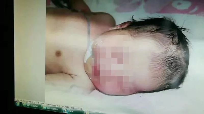 女婴被丢弃在垃圾车内 律师:其父母已构成遗弃