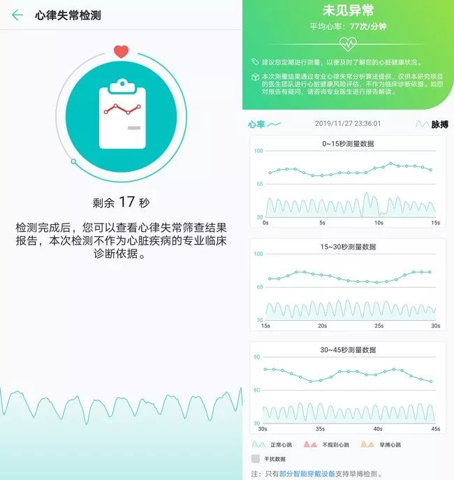 如何利用实时心跳监测技术来改善心脏健康？  第1张