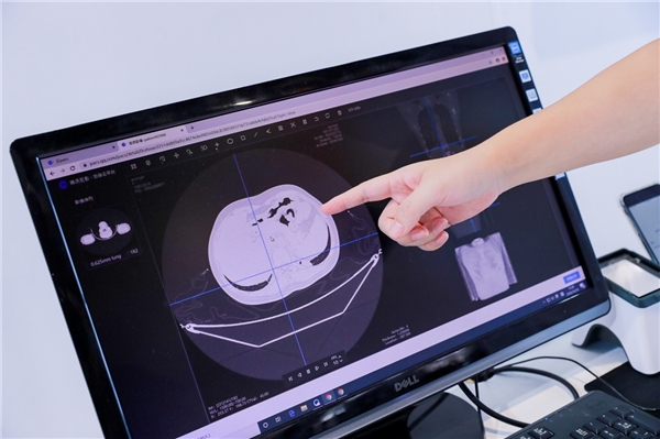 图：腾讯觅影·影像云可以结合企业微信，连接医联体内各级医疗机构